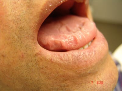 Bu3 ggsxz9 - Eugenol