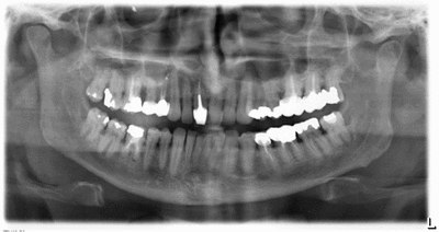 Bxx p 20130412 219 qe4hcs - Eugenol