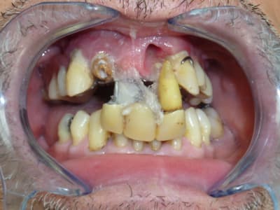 Caca c8gbd9 - Eugenol