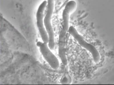 Candida bourgeons gpixrn - Eugenol