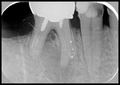 Canovide riuxm5 - Eugenol