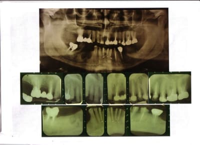 Cas2 gq2goc - Eugenol