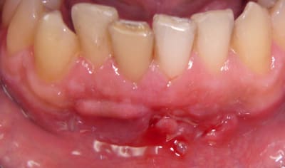 Cas 1 spepaz - Eugenol