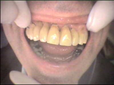 Cas 3 3 z8jrsx - Eugenol