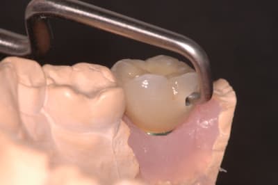 Cas 4 2 hrd2is - Eugenol