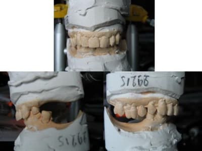 Cas posturo  1 ttywxd - Eugenol