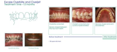 Case2after zdq4xy - Eugenol
