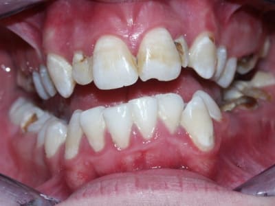 Cata1 owdz3s - Eugenol