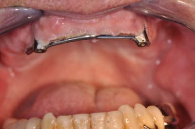 Cavalier3 f2nwmy - Eugenol