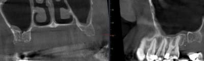 Cbs vlakvn - Eugenol