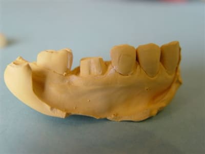 Cerec18 hcxwaa - Eugenol