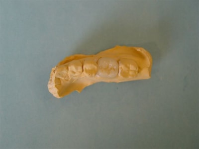 Cerec9 n84lxi - Eugenol