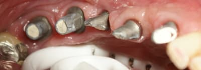 Cinq racines ruldsy - Eugenol