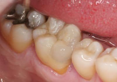 Composite mol apres zajtdf - Eugenol