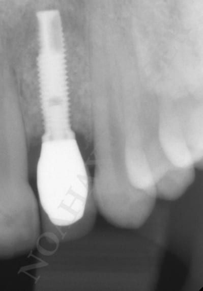 Controle rx   1 an k0l1xw - Eugenol