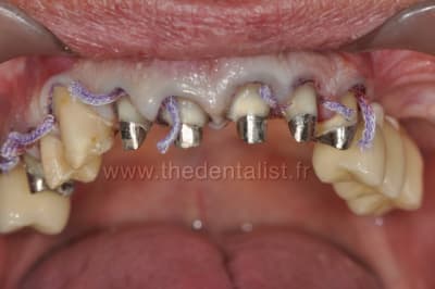 Cordonnets 1 1 ngcewx - Eugenol