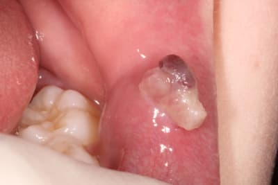 Corentin yibwsq - Eugenol