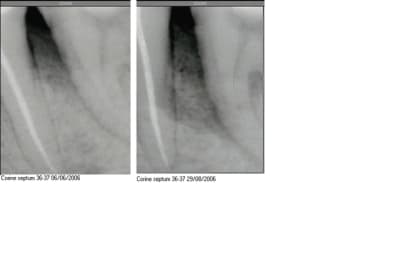 Corinne septum qs2 ieurmm - Eugenol