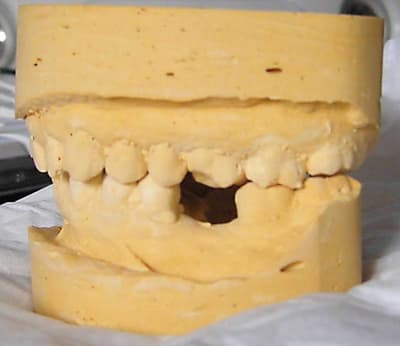 Coté gauche qcle5v - Eugenol