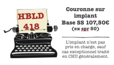 Cour implant png hbhunt - Eugenol