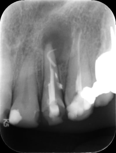 D passement shod1v - Eugenol