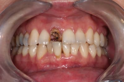 D pose compo vv5rzr - Eugenol