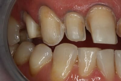 D tail pr p 13 12 11 h6xbci - Eugenol