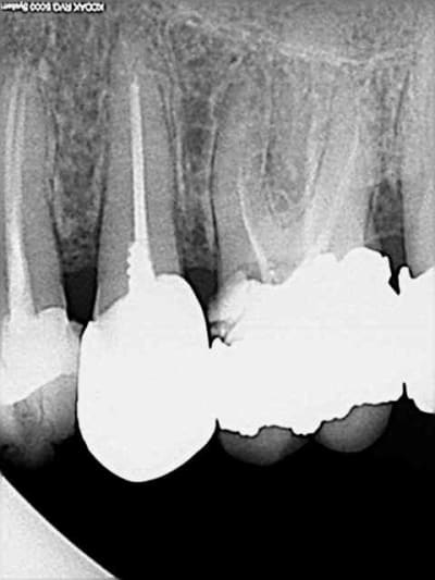 Dac1 y73xfd - Eugenol