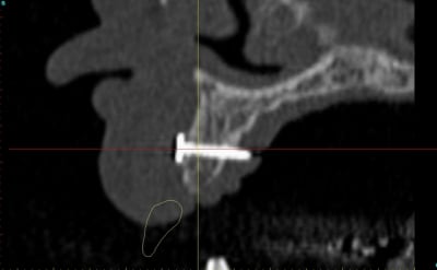 Dar11 cyo3el - Eugenol