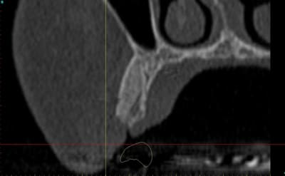 Dar14 actm24 - Eugenol