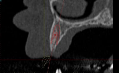 Dar23i g6nxds - Eugenol