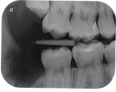 Dds3 lib5mr - Eugenol