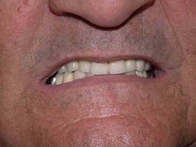 De face i4m5d2 - Eugenol