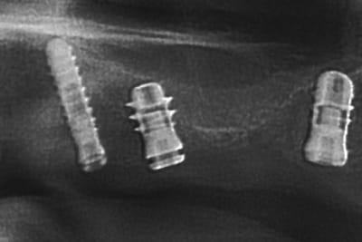 Detail 25 4mois xzkifg - Eugenol