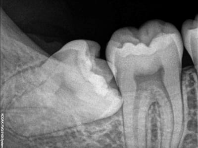 Diihmxwryhajptqmy1cj - Eugenol