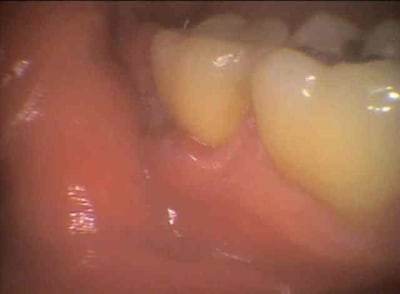 Dion2 azhvt5 - Eugenol