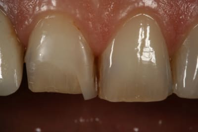 Divers 061 gsvxfr - Eugenol