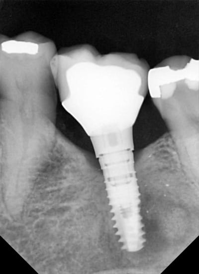 Dlfbxa1uq5pejj0gaqqp - Eugenol