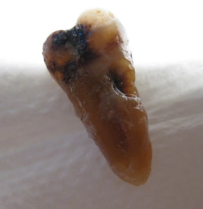 Douleur lr009 izfmrn - Eugenol