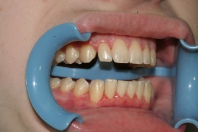 Droite1 qlxs1r - Eugenol