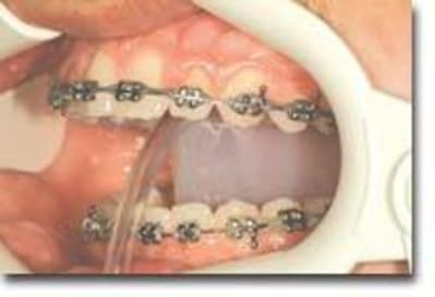 Dryfield sideview twamcw - Eugenol