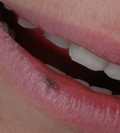 Dsc 0610 s6s5cm - Eugenol