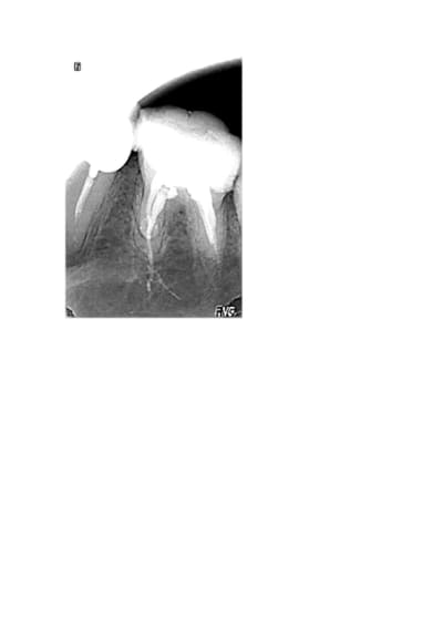 Ducon yrkfsg - Eugenol