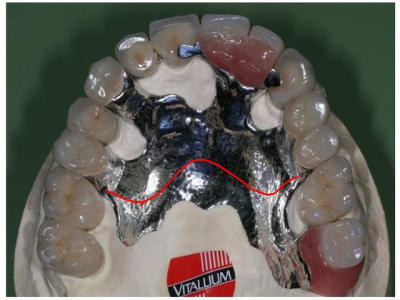 Dudule bhan8z - Eugenol