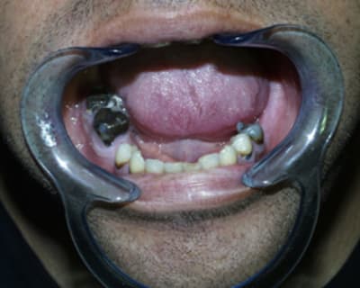 Dvd3 g2d9tw - Eugenol