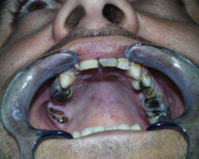 Dvd3 qvmzmm - Eugenol