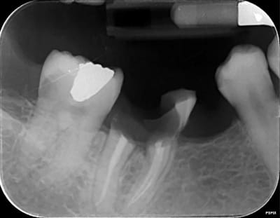 E2qg3vxjfvatvmodwkew - Eugenol