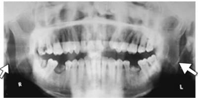 Eagle rdtaqe - Eugenol