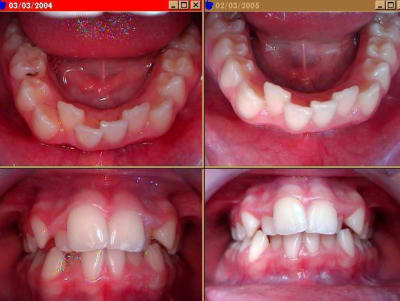 Echec sb dxjrp1 - Eugenol