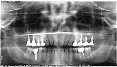 Ef2lw2kcl6ygrhhafuz1 - Eugenol